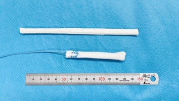 “ウシの腱”を原料に作られた組織再生型靭帯デバイス